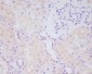 Anti-MMP14/Mt1 Mmp Rabbit Monoclonal Antibody